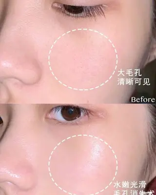 マツエク・マツパ aliaハーブ水光店 エステティシャン募集のエステ・リラクイメージ