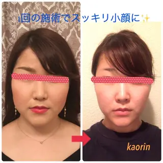 小顔矯正サロン顔凛 KANAのエステ・リラクイメージ