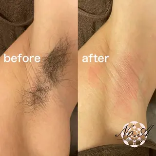 ブラジリアンワックス No.A【新宿】のエステ・リラクイメージ