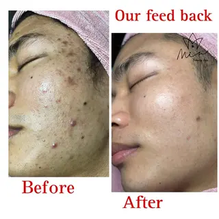 MiA Beautyのエステ・リラクイメージ