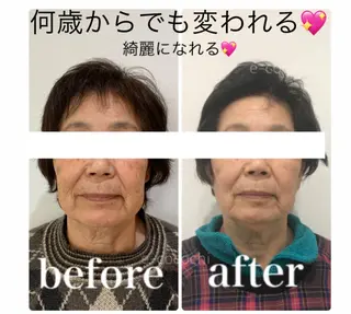 小顔と ヘッドスパのお店のエステ・リラクイメージ