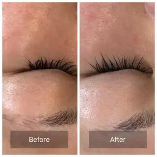 facial aesthetic salon SENTEUR所属・美肌改善/毛穴/シミ サントゥールのエステ・リラクイメージ