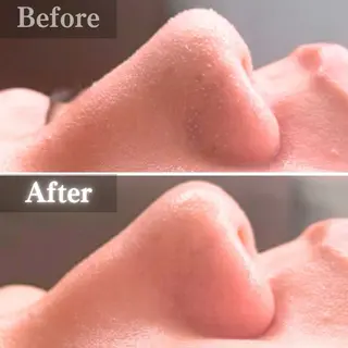 毛穴洗浄特化🫧 オオツカのエステ・リラクイメージ