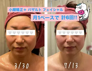35歳からの エイジングケアサロンのエステ・リラクイメージ