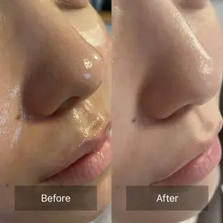 デアイム 長岡東のエステ・リラクイメージ