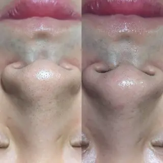 【Morphome】 ﾓﾙﾌｫﾑのエステ・リラクイメージ