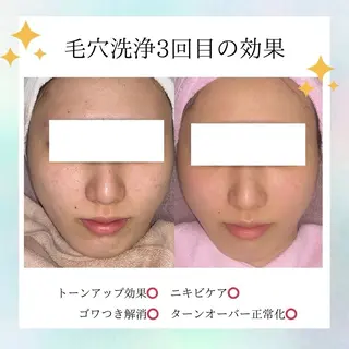 シミ・毛穴専門店 /gracia 安藤のエステ・リラクイメージ