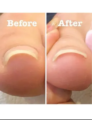 ネイル 俵 結唯のネイルデザイン