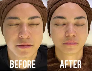 小顔、毛穴ケア 通い放題エステのエステ・リラクイメージ