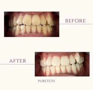 メンズ ホワイトニングサロンPURETETH所属・ホワイトニングサロン PURETETHのエステ・リラクイメージ