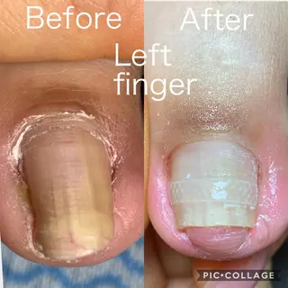 ネイル salon Noelのネイルデザイン