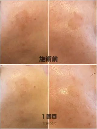 D’accord Rikoのネイルデザイン