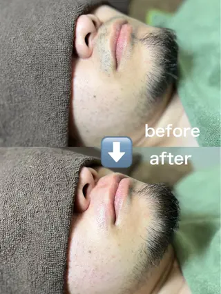 メンズ effet エフェのエステ・リラクイメージ