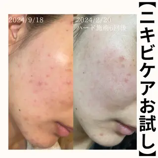 毛穴改善サロン d'Alba大阪住吉のエステ・リラクイメージ