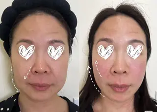 ネイル aliaハイフ&水光ジェットサロン所属・aliaハーブ水光店 エステティシャン募集のエステ・リラクイメージ