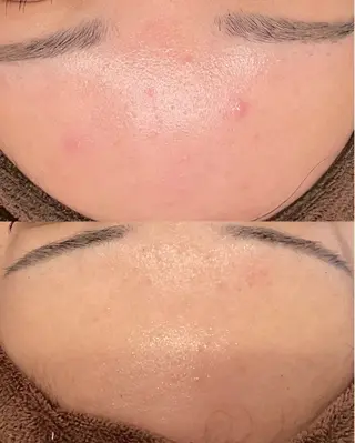 La・Bellvie所属・La･Bellvie 【星ヶ丘店]のエステ・リラクイメージ