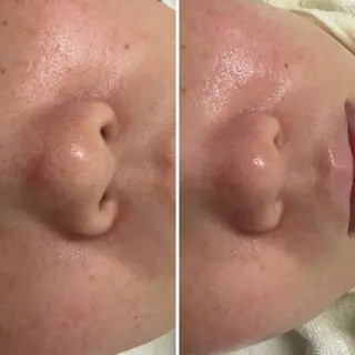 顔脱毛×エステサロン BLOOMi.の眉毛・アイブロウイメージ