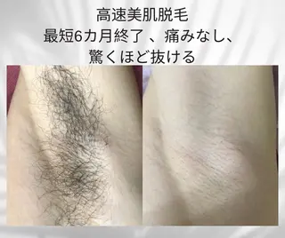 美肌，美ボディ，脱毛 サクラチャンスパのエステ・リラクイメージ