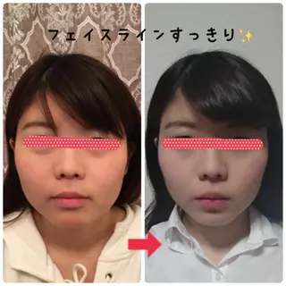 小顔矯正サロン顔凛 KANAのエステ・リラクイメージ