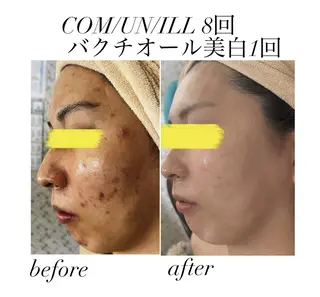 《美肌&小顔サロン》 Masqueradeのエステ・リラクイメージ