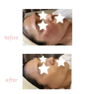 BLOOM〜 天恵（てんのめぐみ）のエステ・リラクイメージ