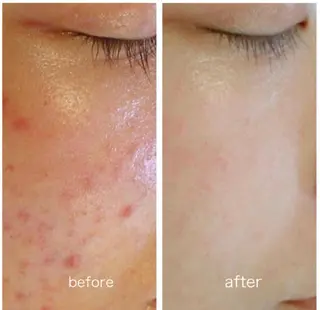 Tipani beaute'のエステ・リラクイメージ