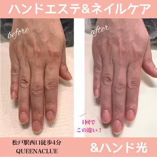 ネイル 毛穴改善/脱毛 ネイル　川上久仁子のエステ・リラクイメージ