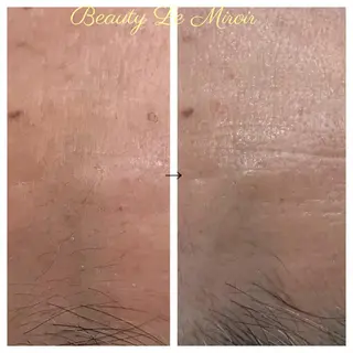 ビューティー ミロワールのエステ・リラクイメージ