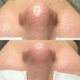 毛穴ケア特化専門店 トネア自由が丘店のエステ・リラクイメージ