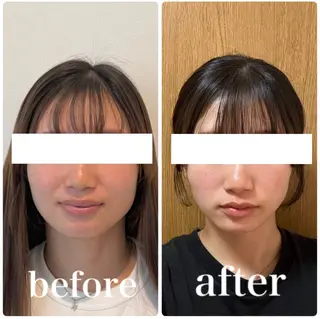 小顔と ヘッドスパのお店のエステ・リラクイメージ