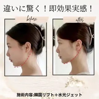 ネイル aliaハーブ水光店 エステティシャン募集のエステ・リラクイメージ