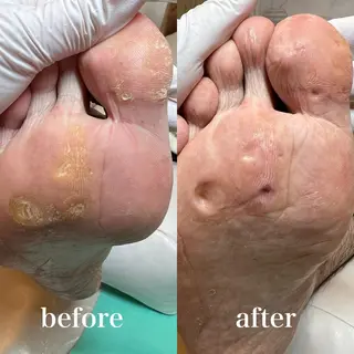 ネイル 東京巻き爪 アカデミーのエステ・リラクイメージ