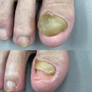 爪の病院屋さん所属・黒田 恵美のその他イメージ