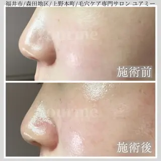 毛穴肌質ケアサロン Yourmeユアミーのエステ・リラクイメージ