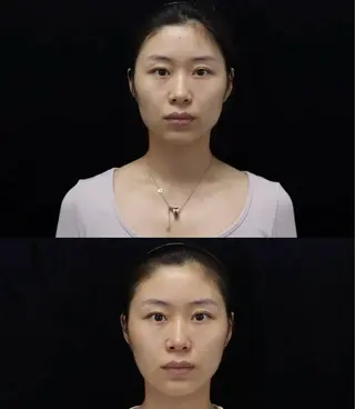 マツエク・マツパ 愛維美水光美肌専門店 メンズレディースokのエステ・リラクイメージ