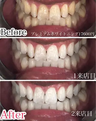 マツエク・マツパ 【歯科提携】柏ホワイ トニングスタイルのその他イメージ