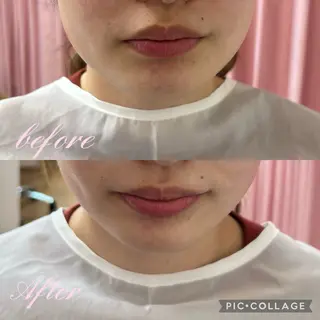 肌質改善 ×ネイルサロンのネイルデザイン