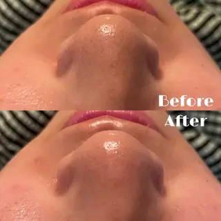 LUMIERE(ルミエル)福岡春吉店所属・LUMIERE 福岡のエステ・リラクイメージ