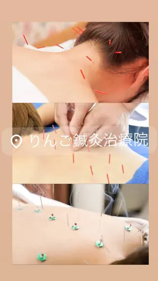 美容鍼灸女性専用 りんご鍼灸治療院のその他イメージ