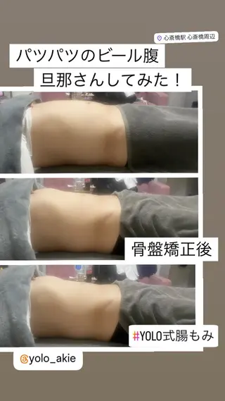 セルライトクラッシュ ＆腸もみ＋骨盤矯正のその他イメージ