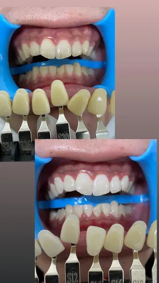 DIA WHITE 奥田のその他イメージ