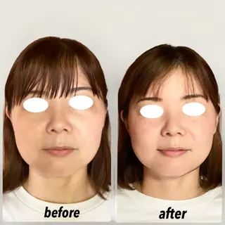 小顔・歪み専門　井元 朋子のエステ・リラクイメージ