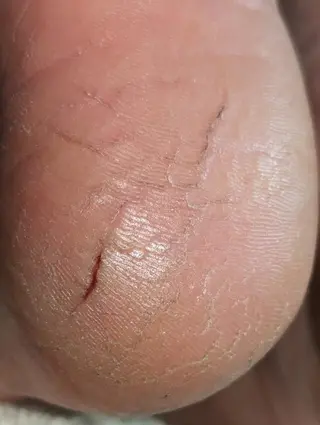 carenail　 tsugumiのその他イメージ