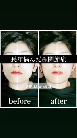 🌈歪み改善🌈 バリンタイ すぎうらのエステ・リラクイメージ