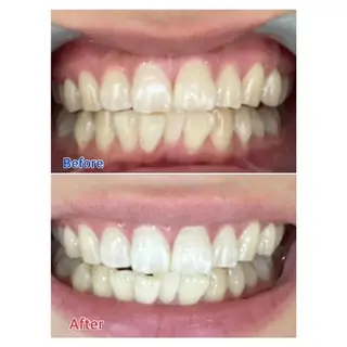 M渋谷 ホワイトニングのエステ・リラクイメージ