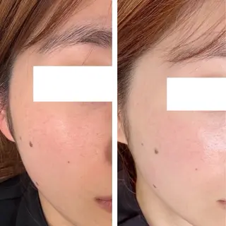 シミケア専門サロンLICCO’S所属・シミケア専門サロン LICCO’S岡崎のエステ・リラクイメージ