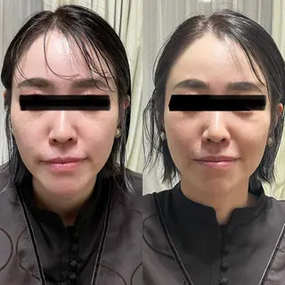 マッツンの 鍼のその他イメージ