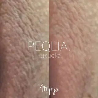 【フェムケア専門店】 PEQLIA福岡のエステ・リラクイメージ