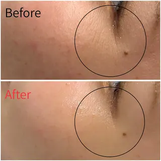 MORE BEAUTY ESTHE 本通り店所属・more ‎‪𓍯 ‬のエステ・リラクイメージ