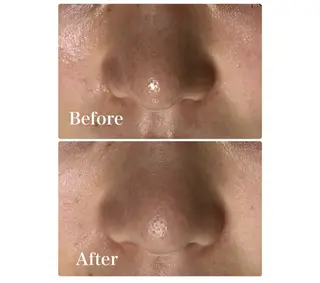 ROR Akariのエステ・リラクイメージ